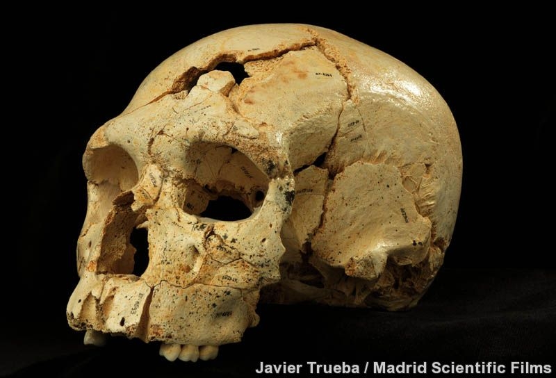 Cráneo número 17, la joya de la colección. Crédito: Javier Trueb