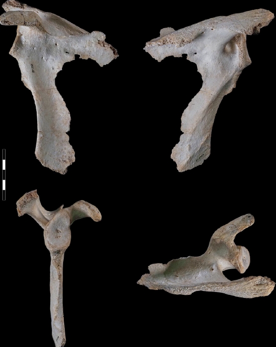 Adult scapula from the right side Top anterior (left) and posterior (right) views Bottom lateral (left) and superior (right) views